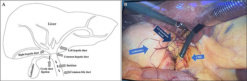 LAPAROSCOPIC SURGERY in jalpaiguri