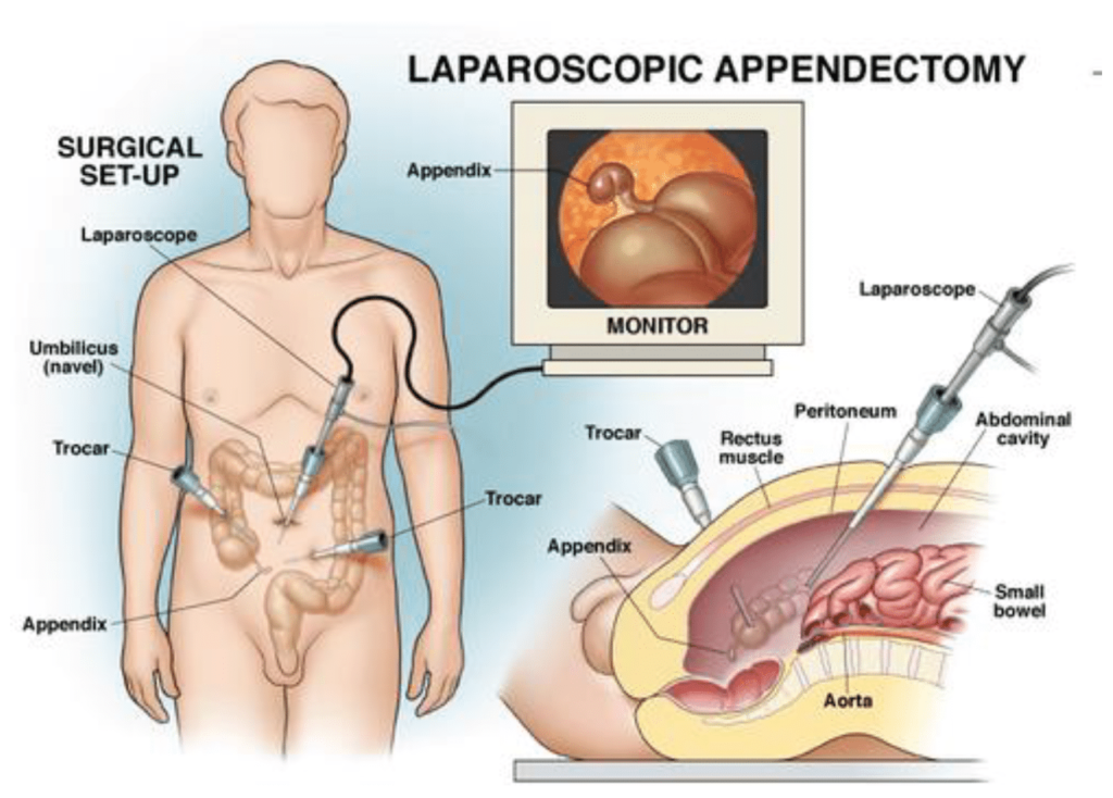 Advanced Laparoscopic Surgeon in Jalpaiguri