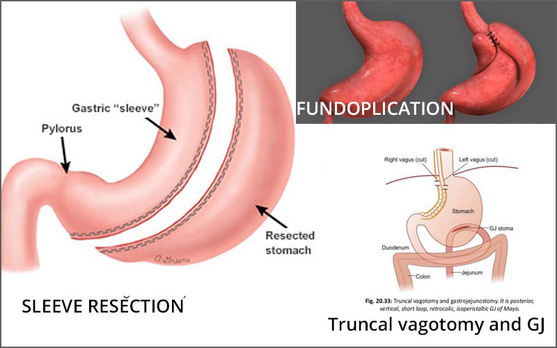 laparoscopic surgeon in Jalpaiguri